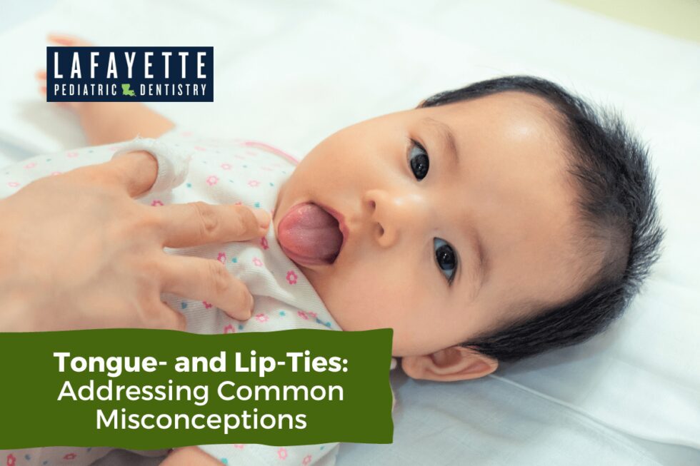 Tongue- and Lip-Ties: Addressing Common Misconceptions - Lafayette ...