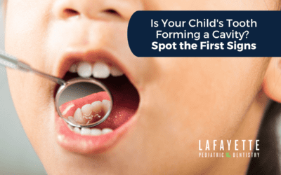 Is Your Child’s Tooth Forming a Cavity? Spot the First Signs