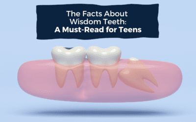 The Facts About Wisdom Teeth: A Must-Read for Teens