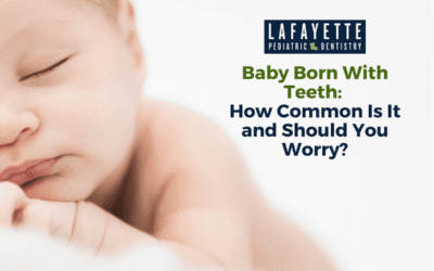 Baby Born With Teeth: How Common Is It and Should You Worry?