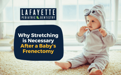 Why Stretching is Necessary After a Baby’s Frenectomy