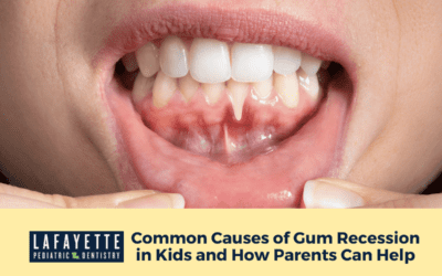 Common Causes of Gum Recession in Kids and How Parents Can Help