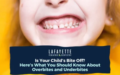 Is Your Child’s Bite Off? Here’s What You Should Know About Overbites and Underbites