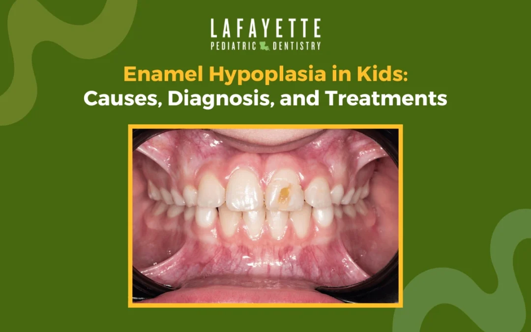 Enamel Hypoplasia in Kids: Causes, Diagnosis, and Treatments
