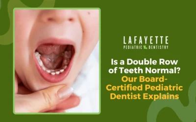 Is a Double Row of Teeth Normal? Our Board-Certified Pediatric Dentist Explains