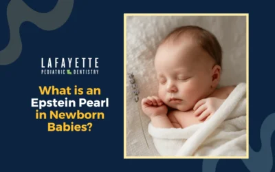 What is an Epstein Pearl in Newborn Babies?