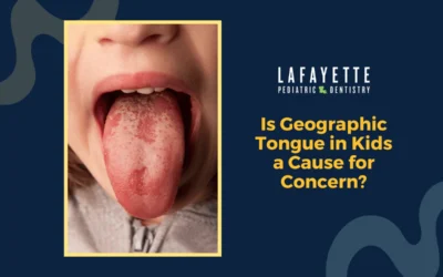 Is Geographic Tongue in Kids a Cause for Concern?