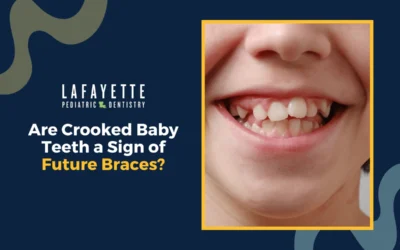 Are Crooked Baby Teeth a Sign of Future Braces?