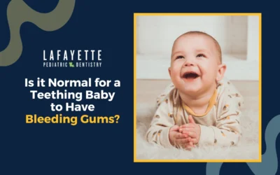 Is it Normal for a Teething Baby to Have Bleeding Gums?