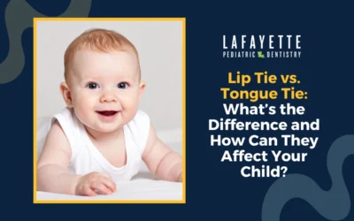 Lip Tie vs. Tongue Tie: What’s the Difference and How Can They Affect Your Child?