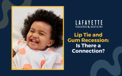 Lip Tie and Gum Recession: Is There a Connection?