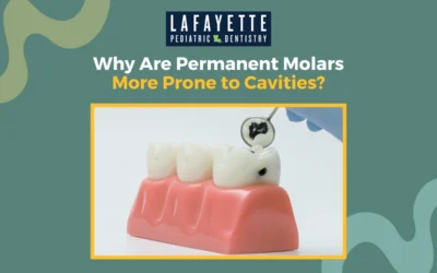 Why Are Permanent Molars More Prone to Cavities?